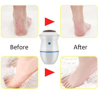 Foot Care Tool Electric Foot Dead Skin Exfoliator